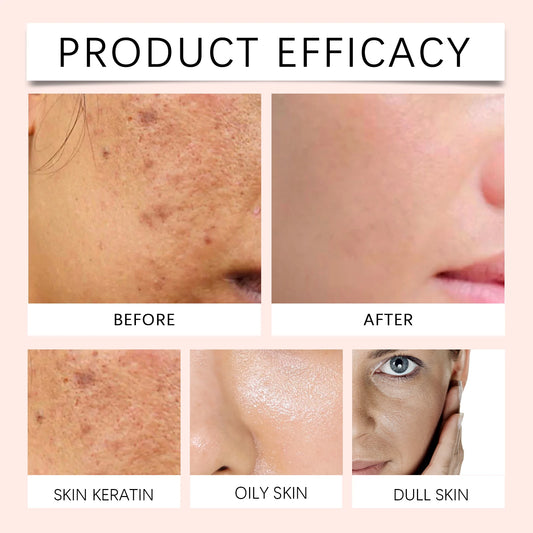 HOYGI Sakura Exfoliating Gel Facial Cleansing Pores Moisturizing Gentle Exfoliate Oil Control Reduce Blackheads Smooth Skin Care