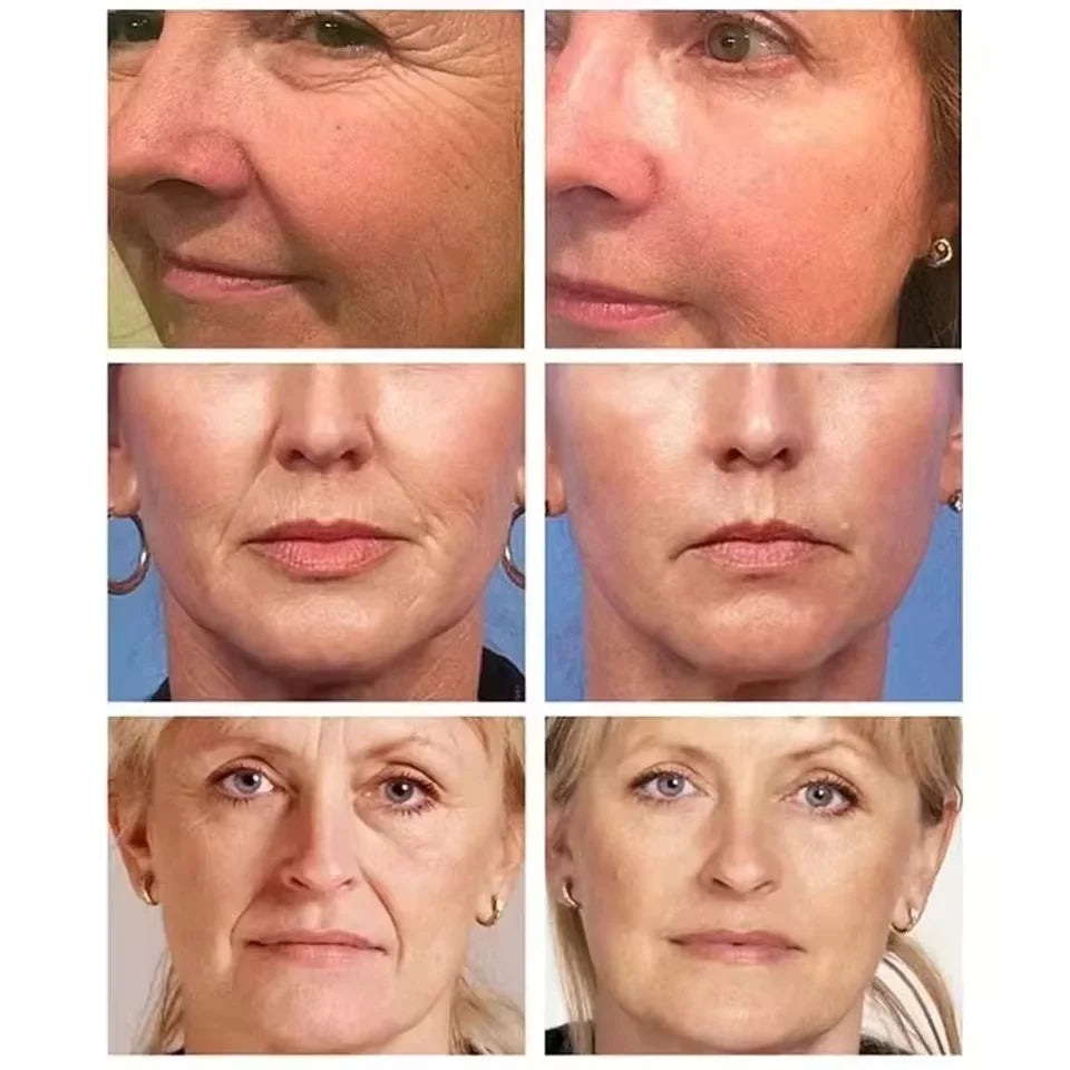 PDRN Collagen Masks Anti Wrinkle Fade Fine Lines Moisturize Brightening Glass Glow Skin Elasticity SkinCare Korean Cosmetics