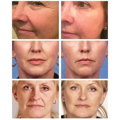 PDRN Collagen Masks Anti Wrinkle Fade Fine Lines Moisturize Brightening Glass Glow Skin Elasticity SkinCare Korean Cosmetics