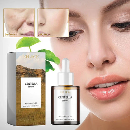 Centella Asiatica Face Serum Nourish Dry Skin Smoothing Rejuvenation Skin Brightening Whitening Cream Facial Moisturizer Korean
