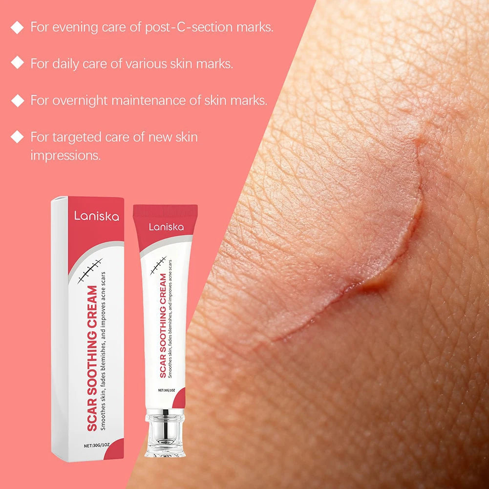 Scars Cream Scars Reducing Treatments Gel Not Irritate Skin Effective Safety Gel Stretch Marks Lightweight Fast Absorption