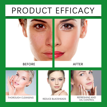 Aloe Cleansing Foam Gently Cleanses The Face Deeply Hydrates Pores Controls Oil Moisturizes And Is Comfortable Without Tightness