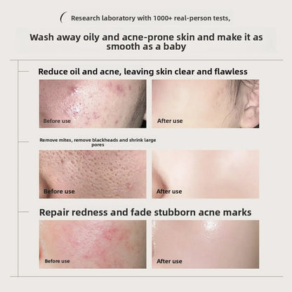 RUYI Chlorophyll Amino Acid Facial Cleanser Milk Blackhead Reduction Control Oil Shrinking Pores Gental Face Cleansing Foam 300g
