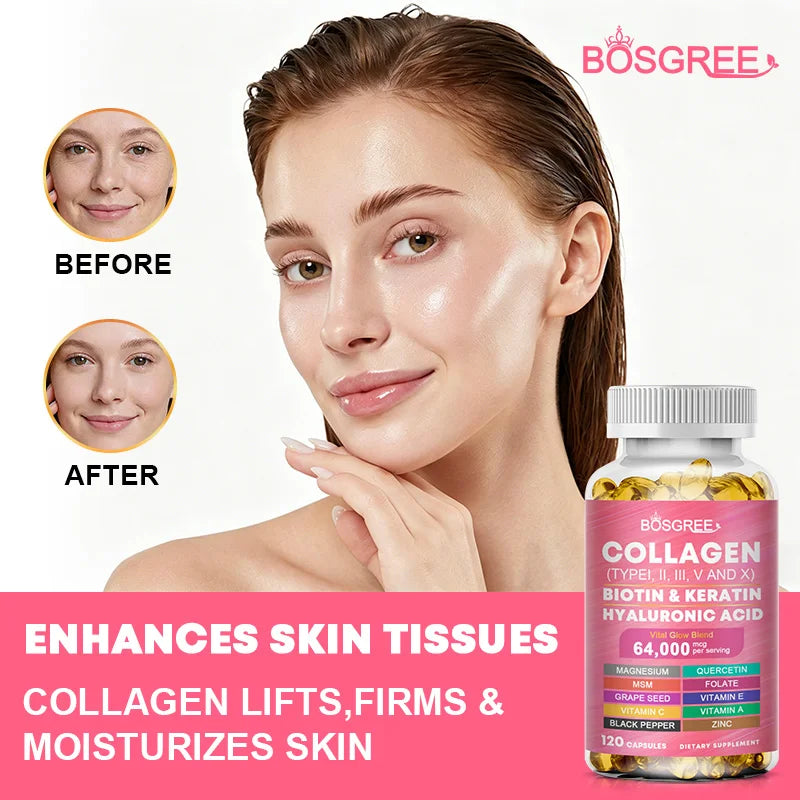 Multi-Collagen Biotin Keratin Skin Care-Women's Collagen Supplement-Hyaluronic Acid,Vitamins C&E- Skin,Hair,Nails&Joint Support